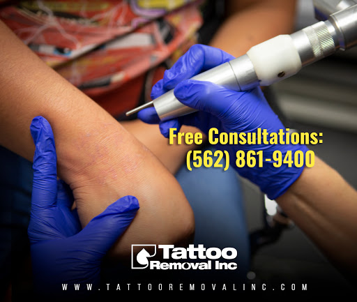 Explore calf tattoo ideas male, creative tattoo ideas in South Gate, available at Tattoo Removal Inc