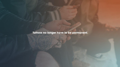 Tattoo removal service West Valley City