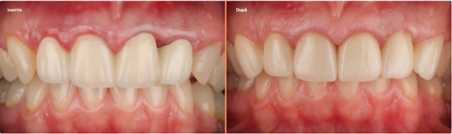 Opinii despre Royal Smile Clinic - Estetică, Protetică și Implantologie Dentară în Oradea - Dentist
