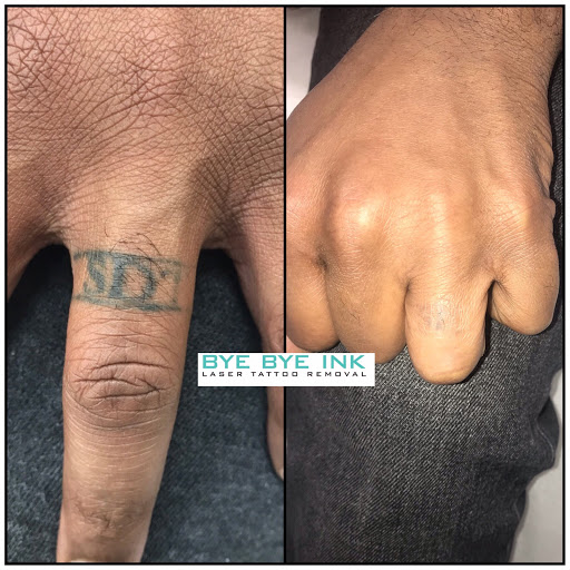 Find finger tattoo ideas for men for your next unique tattoo in Middle Village at Bye Bye Ink Laser Tattoo Removal