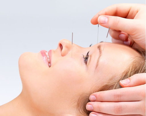 Acupuncture Health Solutions