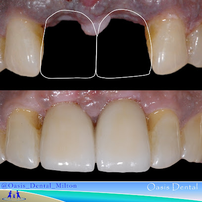 Milton Dentist Oasis Dental - Cosmetic Family Implant Kid Orthodontic Braces TMJ Pain Clinic
