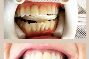 The Teeth Whitening Lab - Christchurch Former Dental Therapist