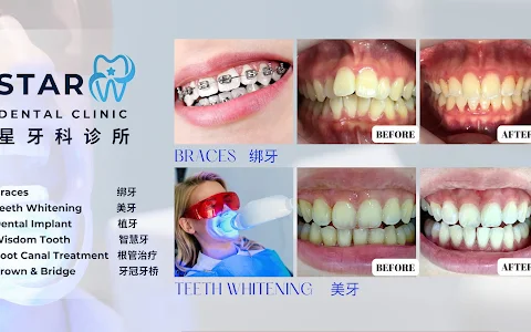 Star Dental Clinic Bukit Mertajam 星牙科 -Implant & Braces Centre image