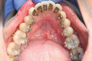 TEETH N BRACES image