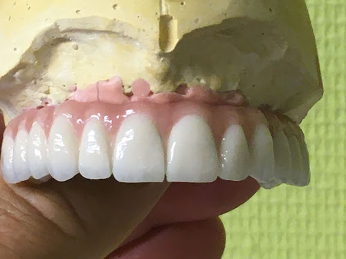 Centre de prothèses dentaires Castellane Prothèses Dentaires M Ranchin Marseille
