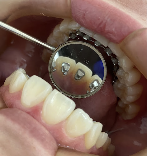 Opiniones de Centro de Ortodoncia y Rehabilitación Dental en Cuenca - Dentista