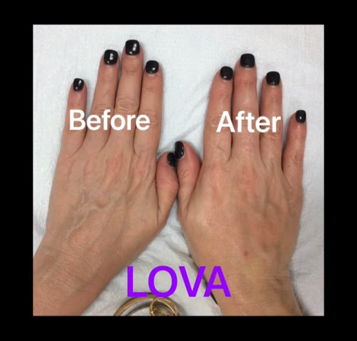 Explore music sleeve tattoo ideas, creative tattoo ideas in Lake Oswego, available at Lake Oswego Vein and Aesthetic LOVA