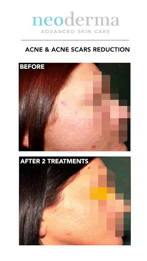 Explore mens sleeve tattoo filler ideas, creative tattoo ideas in Anaheim, available at Neoderma