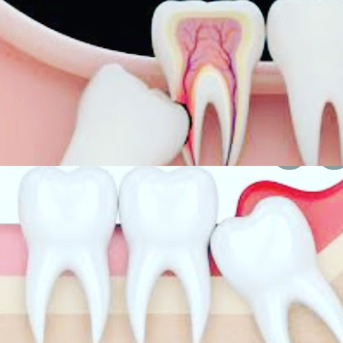 Carolay Perez dentist - Dentista