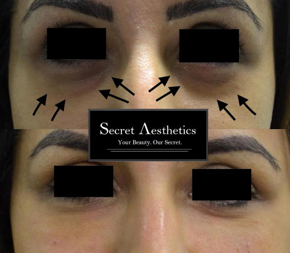 Comments and reviews of Secret Aesthetics
