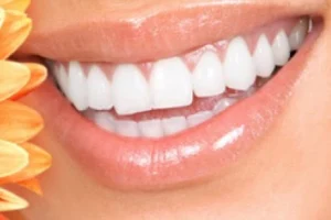 Bright Smile Dentistry- Dr Rassam-Zora image