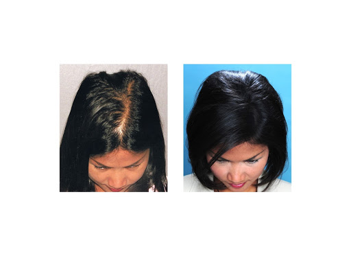 Hair Transplantation Clinic «Bosley Medical - Dallas», reviews and photos, 5949 Sherry Ln #1150, Dallas, TX 75225, USA