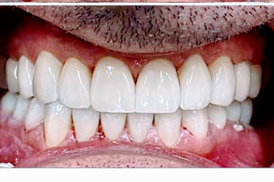 Klinika Dentare Mela Dent image