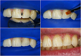 Cabinet Stomatologic -Microscopie Dentara Dr. Buliga Daniel