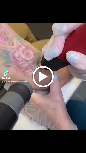 Explore maltese cross tattoo ideas, creative tattoo ideas in Port Charlotte, available at Envision Laser Removal