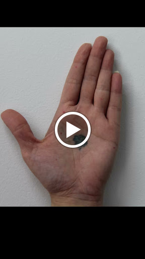 Explore trash polka tattoo ideas, creative tattoo ideas in New York, available at Ag2g Laser Tattoo Removal & MedSpa