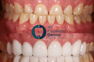 All Cosmetic Dental image