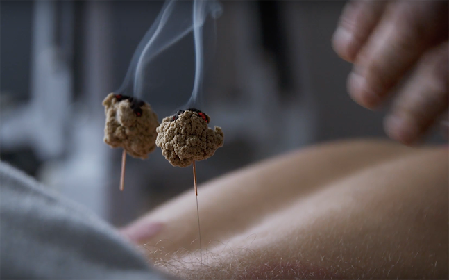 Anmeldelser af Akupunkturklinikken i Hjørring - Akupunkturklinik