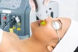 Laser Concept Epilation, Cryolipolyse et Peelings image