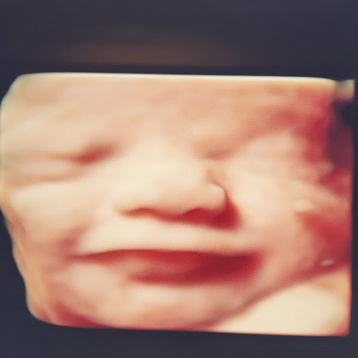Baby Wave 4D Ultrasound image