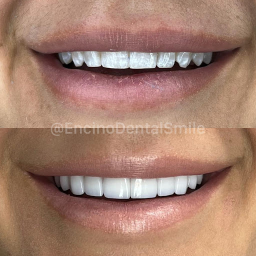 Encino Dental Smile image