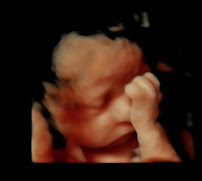 Baby Bump Imaging - Photo 6 - Car repair in Lee's Summit, MO, Lee's Summit