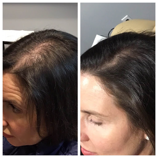 Explore four horsemen tattoo ideas, creative tattoo ideas in Portland, available at Oregon Medical & Laser (formerly Cascade Medical & Tattoo Removal)