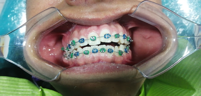 Opiniones de Odontología estética y rehabilitación dental en Ayacucho - Dentista