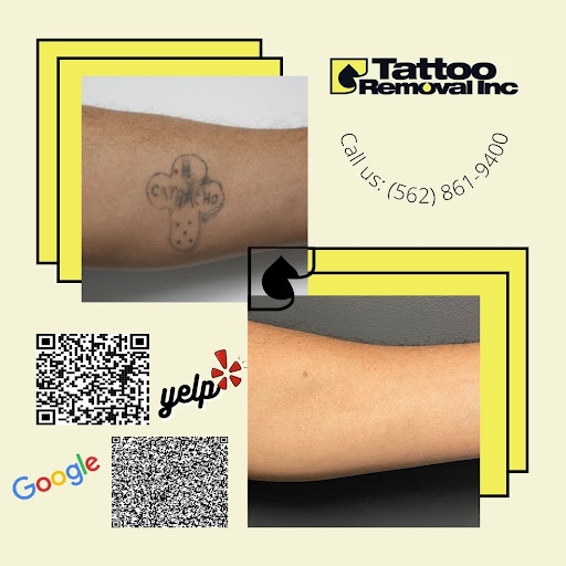 Explore always tattoo ideas, creative tattoo ideas in South Gate, available at Tattoo Removal Inc