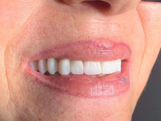 Dentist Crangasi Bucuresti Remis Constantin - Implant Dentar - Fast And Fixed Proteza Fixa / Dantura Fixa 24h