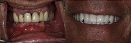 Brooklyn Heights Dental: Eugene D. Stanislaus, DDS Photo