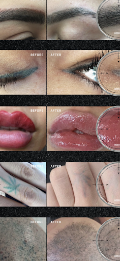 Explore denver nuggets tattoo ideas, creative tattoo ideas in Victorville, available at Goawaytats tattoo removal