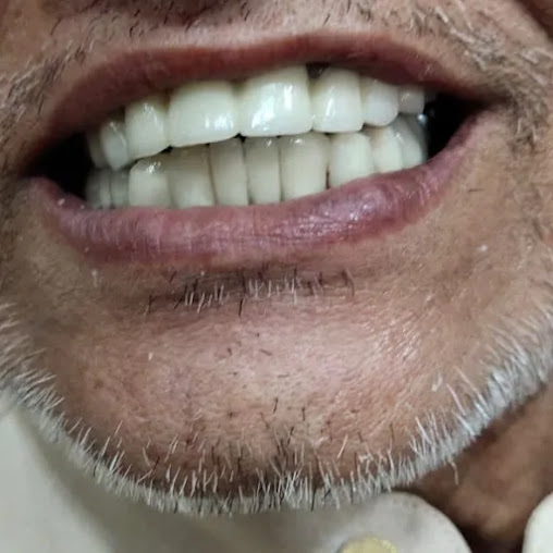 Dentys Dental Care - Kondapur - Dentys Dental Care - Kondapur