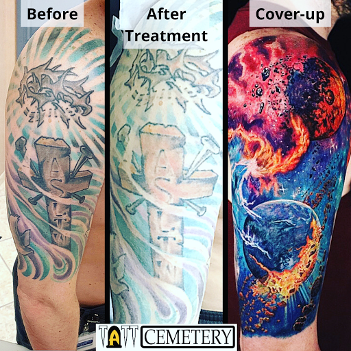 Explore butterfly shoulder tattoo ideas, creative tattoo ideas in Fort Myers, available at Laser Tattoo Removal by Tatt Cemetery