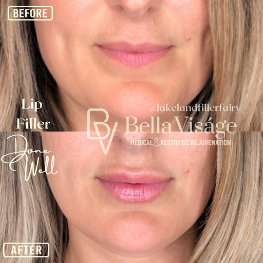 Explore lumalee tattoo ideas, creative tattoo ideas in Lakeland, available at Bella Visge Medical & Aesthetic Rejuvenation