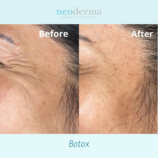 Explore small country tattoo ideas, creative tattoo ideas in Anaheim, available at Neoderma