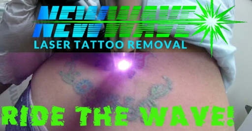 Explore bf gf tattoo ideas, creative tattoo ideas in Bethlehem, available at New Wave Laser Tattoo Removal