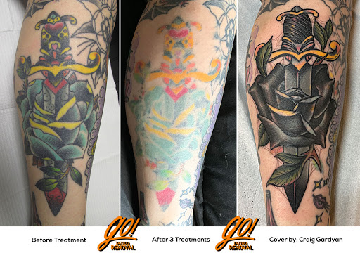 Explore koala tattoo ideas, creative tattoo ideas in Allentown, available at Removery Tattoo Removal & Fading