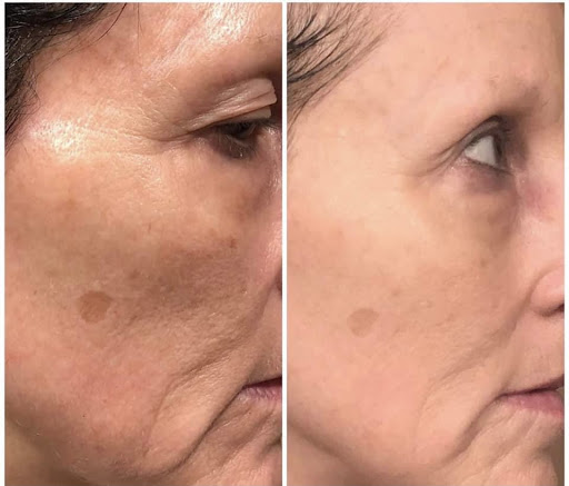 Explore tattoo ideas for miscarriage, creative tattoo ideas in Savannah, available at Haute Brows. Cosmetic Tattoo