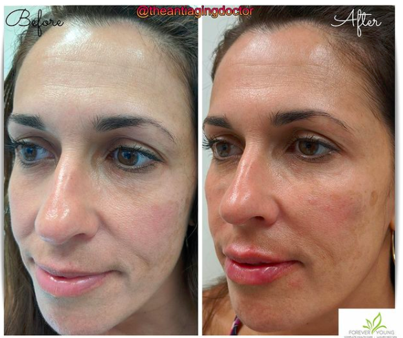 Forever Young Complete Healthcare 08830
