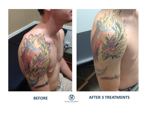 Explore dad and daughter tattoo ideas, creative tattoo ideas in San Diego, available at Removery Tattoo Removal & Fading