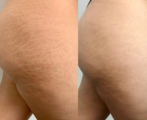 Explore tattoo ideas sports, creative tattoo ideas in Aurora, available at Tranquil Soul Ink (located inside Sola Salon Studios)