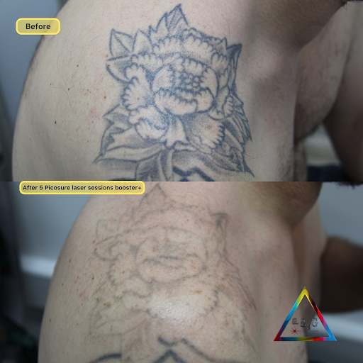 Explore mechanic tattoo ideas for guys, creative tattoo ideas in New York, available at Ag2g Laser Tattoo Removal & MedSpa