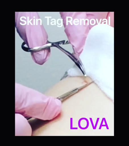 Explore cute face tattoo ideas, creative tattoo ideas in Lake Oswego, available at Lake Oswego Vein and Aesthetic LOVA