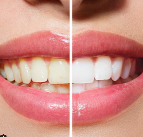 Beauty Salon «Sunless Beauty - Organic Spray Tanning, Makeup, Mobile and Salon», reviews and photos, 2746 Pacific Coast Hwy #9, Torrance, CA 90505, USA