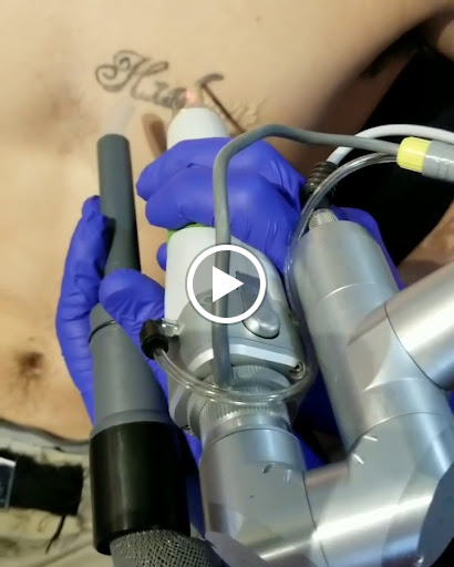 Explore lebron james tattoo ideas, creative tattoo ideas in Reno, available at Reno Tattoo Removal