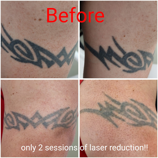 Explore knee tattoo ideas for men, creative tattoo ideas in Brighton, available at Valkyrie Tattoos