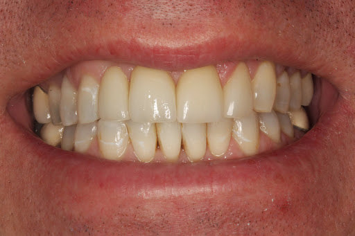 Dentist «Dentistry In Bellevue», reviews and photos