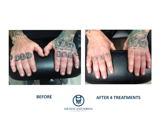 Explore men thigh tattoo ideas, creative tattoo ideas in San Diego, available at Removery Tattoo Removal & Fading